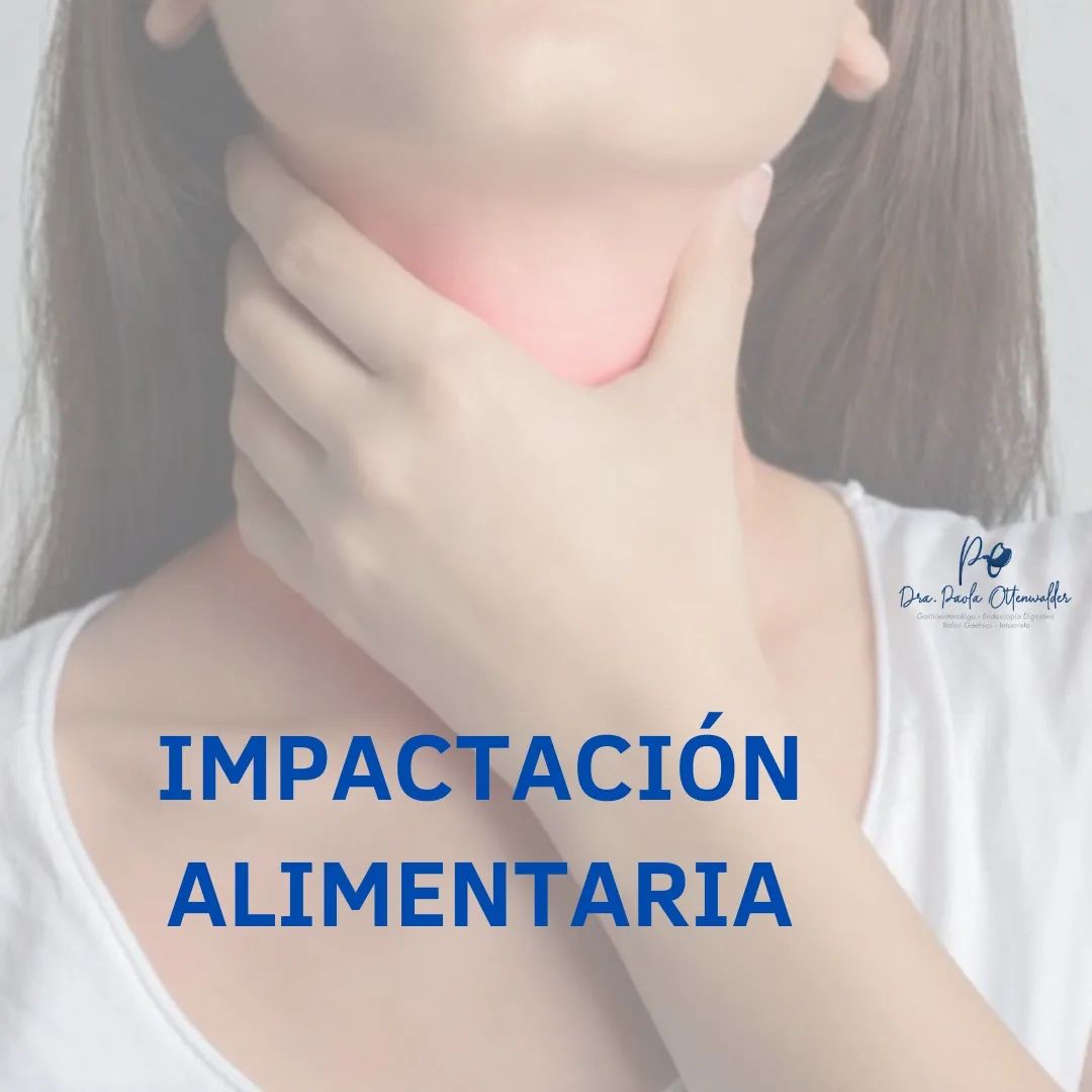 impactación alimentaria